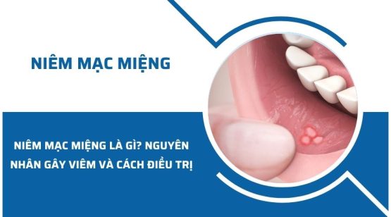 Niêm mạc miệng là gì? Nguyên nhân gây viêm và cách điều trị