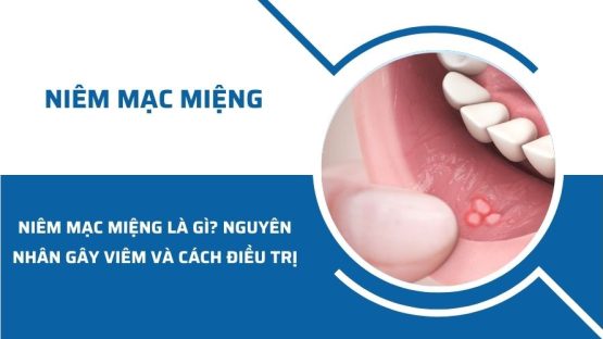 Niêm mạc miệng là gì? Nguyên nhân gây viêm và cách điều trị