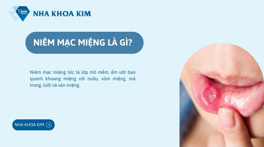 Niêm mạc miệng là gì?