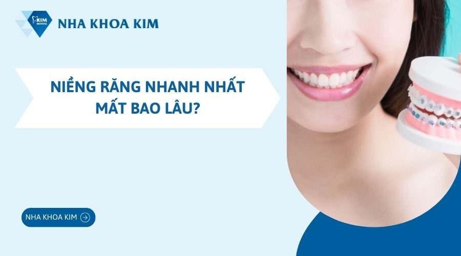 Niềng răng nhanh nhất mất bao lâu?