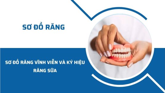 Sơ đồ răng vĩnh viễn và kí hiệu răng sữa