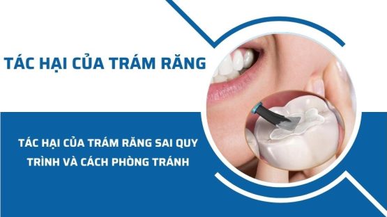 Tác hại của trám răng sai quy trình và cách phòng tránh