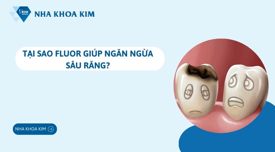 Tại sao Fluor giúp ngăn ngừa sâu răng?