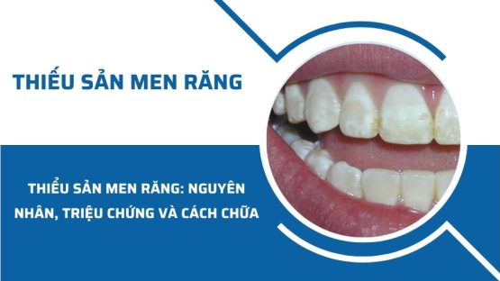 Thiếu sản men răng: Nguyên nhân, triệu chứng và cách chữa