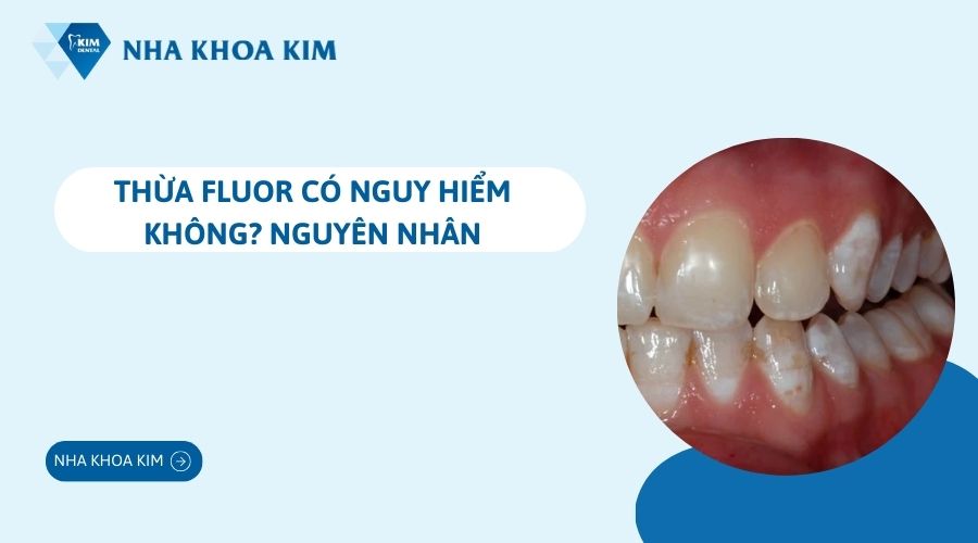 Thiếu hoặc thừa Fluor có nguy hiểm không?