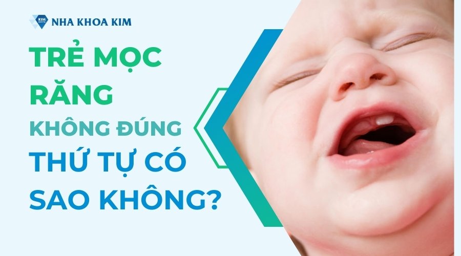 Trẻ mọc răng không đúng thứ tự có sao không?