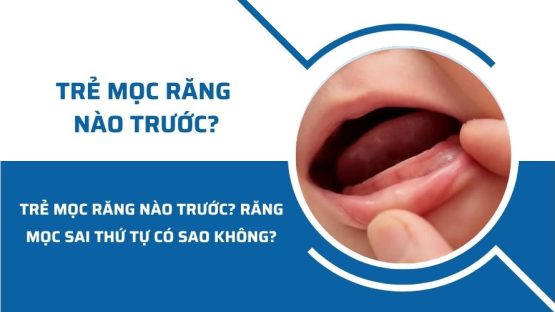 Trẻ mọc răng nào trước? Răng mọc sai thứ tự có sao không?