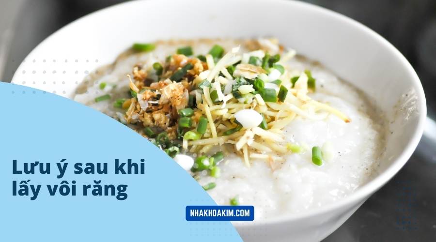 Những lưu ý sau khi lấy vôi răng