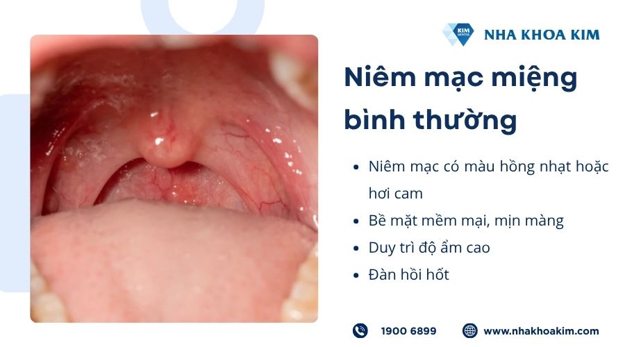 Niêm mạc miệng bình thường