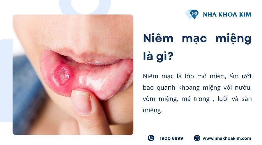 Niêm mạc miệng là gì