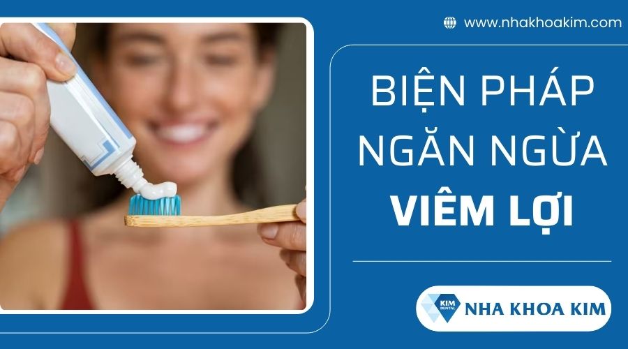 Biện pháp ngăn ngừa viêm lợi