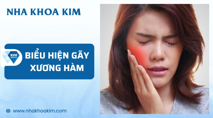 Biểu hiện của gãy xương hàm