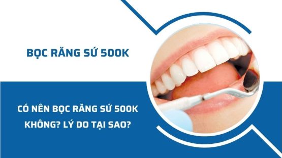 Có nên bọc răng sứ 500K không? Tại sao?