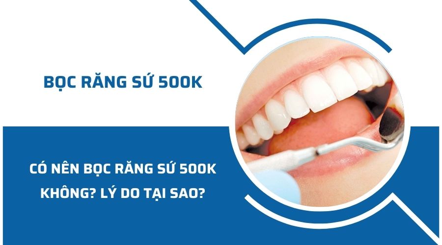 Có nên bọc răng sứ 500K không? Tại sao?