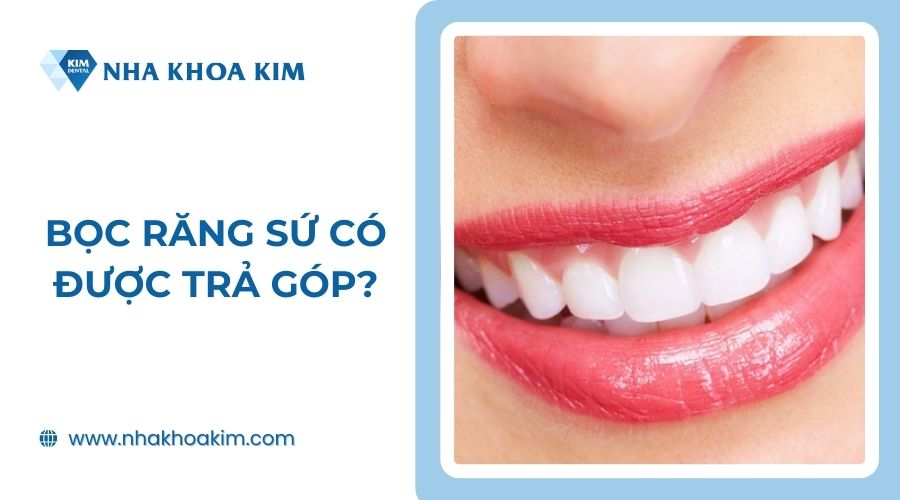 Bọc răng sứ có được trả góp không?