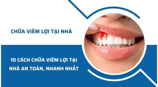 10 cách chữa viêm lợi tại nhà an toàn, nhanh nhất