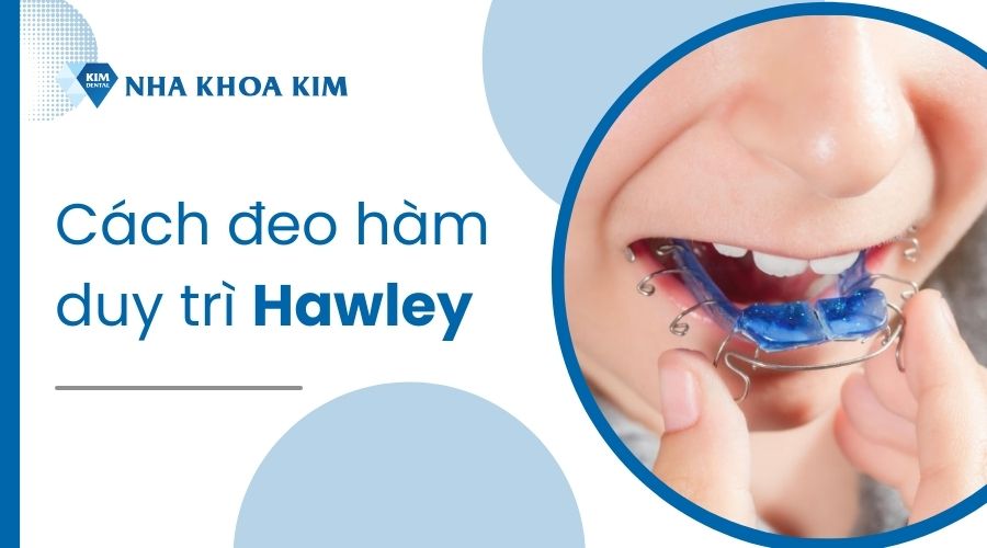Cách đeo hàm duy trì Hawley