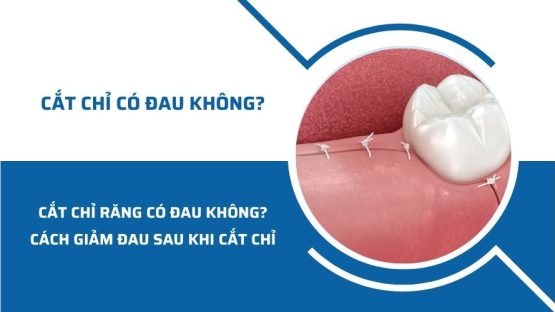 Cắt chỉ răng có đau không? Cách giảm đau sau khi cắt chỉ