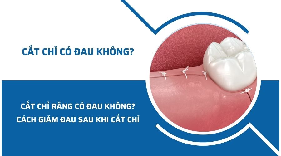 Cắt chỉ răng có đau không? Cách giảm đau sau khi cắt chỉ