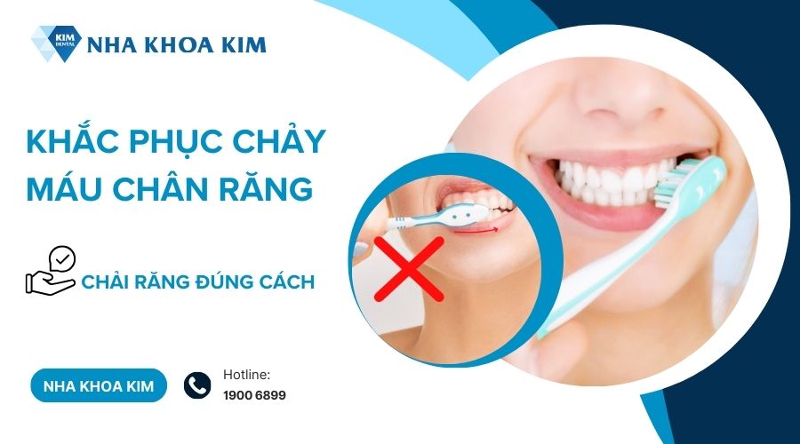 Chải răng đúng cách giúp hạn chế tình trạng chảy máu chân răng