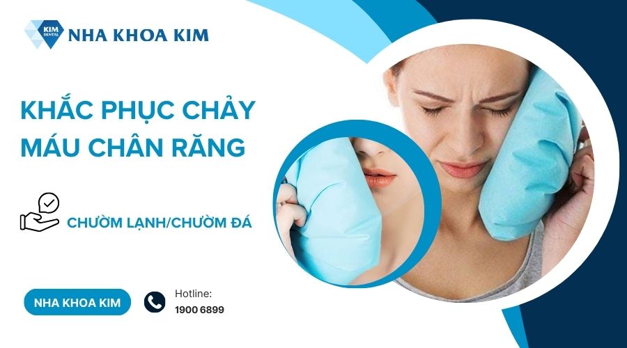 Chườm lạnh giúp giảm tình trạng chảy máu chân răng