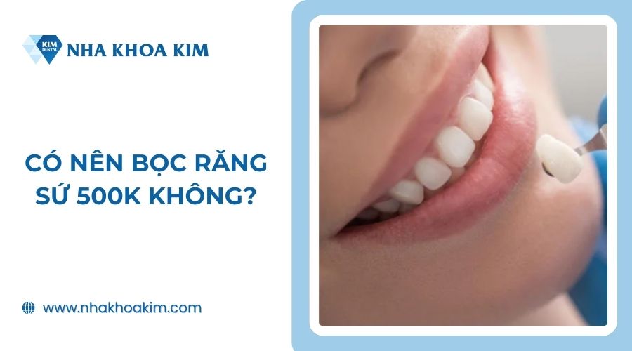 Có nên bọc răng sứ 500k không?