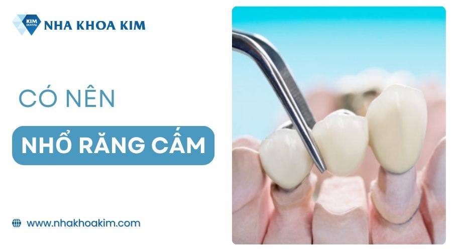 Có nên nhổ răng cấm không?