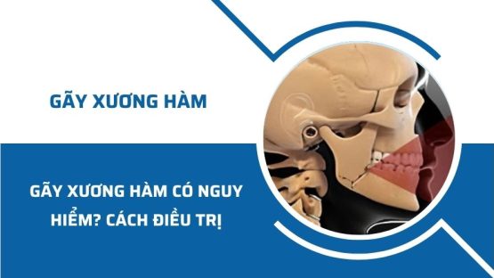 Gãy xương hàm có nguy hiểm không? Cách điều trị