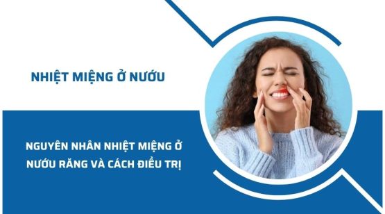 Nguyên nhân nhiệt miệng ở nướu răng và cách điều trị