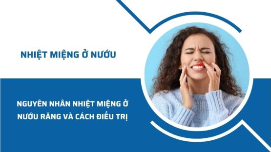 Nguyên nhân nhiệt miệng ở nướu răng và cách điều trị