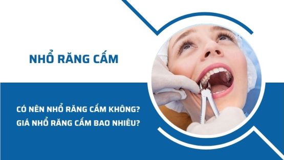 Có nên nhổ răng cấm không? Giá nhổ răng cấm bao nhiêu?