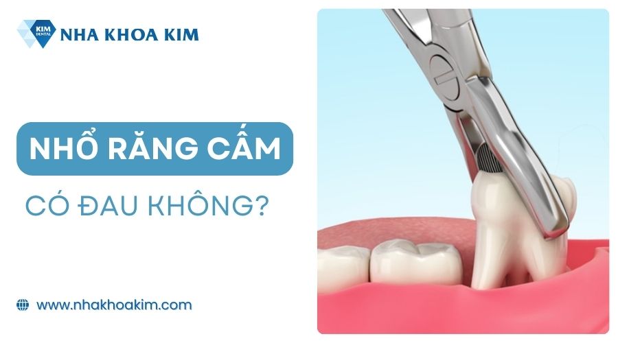 Nhổ răng cấm có đau không?
