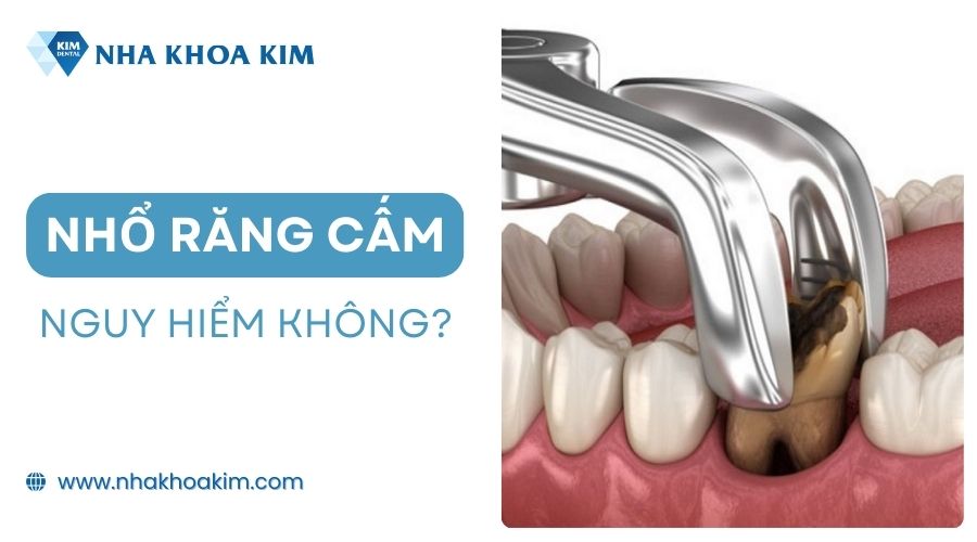 Nhổ răng cấm có nguy hiểm không