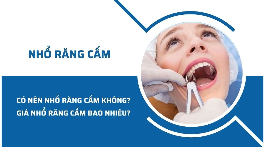 Có nên nhổ răng cấm không? Giá nhổ răng cấm bao nhiêu?