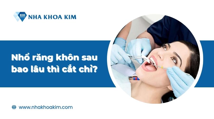 Nhổ răng khôn sau bao lâu thì cắt chỉ?