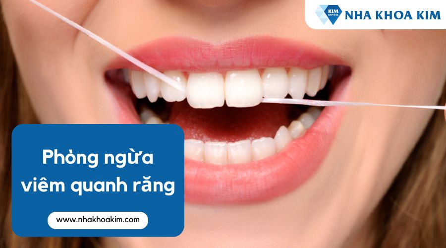 Biện pháp phòng ngừa viêm quanh răng