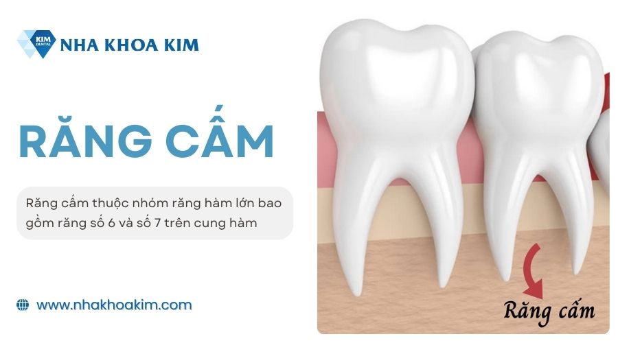 Răng cấm là răng ở vị trí nào?