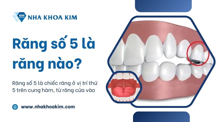 Răng số 5 là răng nào?