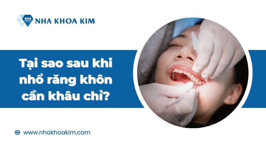 Tại sao sau khi nhổ răng khôn cần khâu chỉ?