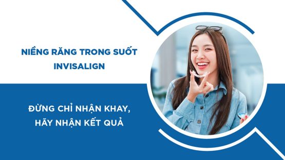 Niềng răng trong suốt Invisalign: Đừng chỉ nhận khay, hãy nhận kết quả