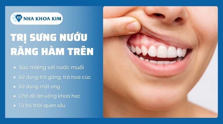 Cách trị sưng nướu răng hàm trên an toàn