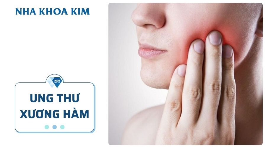 Ung thư xương hàm