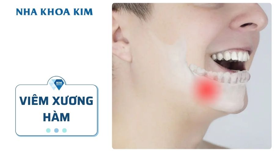 Viêm xương hàm
