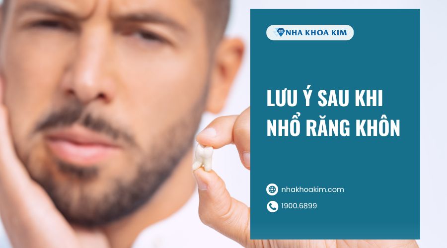Lưu ý sau khi nhổ răng khôn mọc thẳng