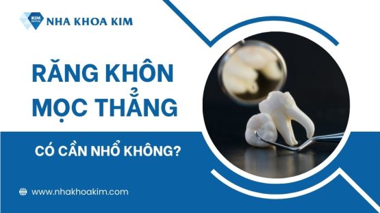 Răng khôn mọc thẳng có cần nhổ không? Vì sao?