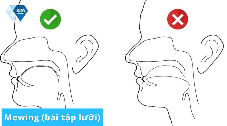 Bài tập mewing cải thiện Jawline nhanh chóng tại nhà