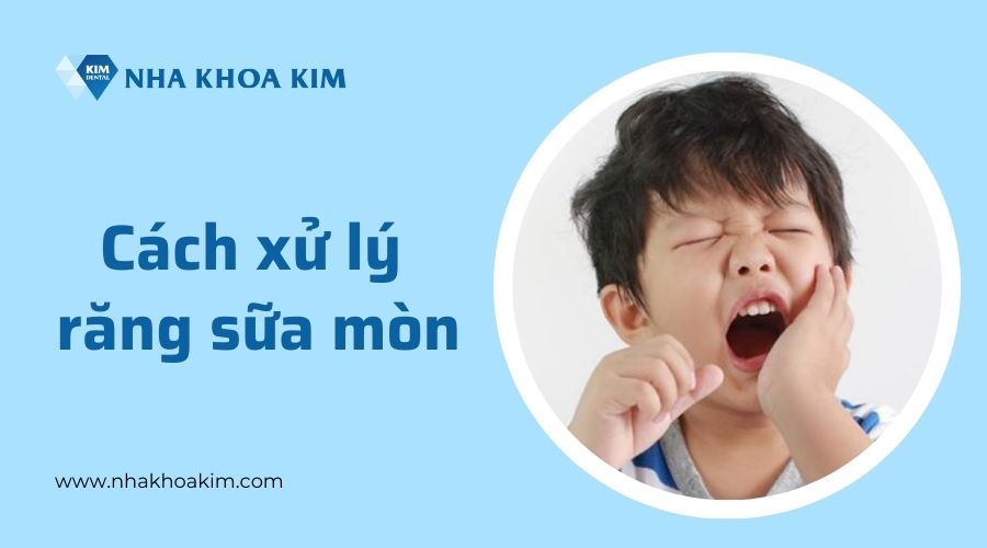 Cách xử lý khi răng sữa của trẻ bị mòn