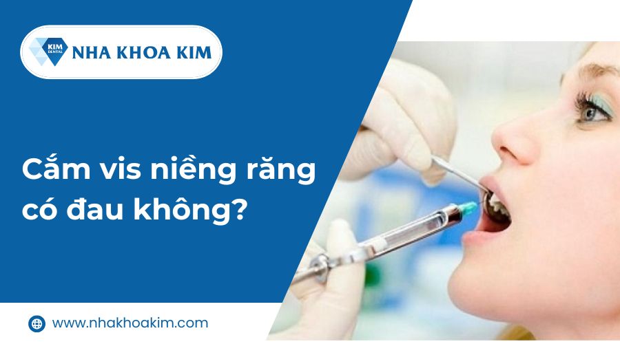 Cắm vít niềng răng có đau không?