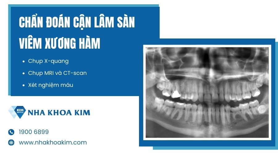 Chẩn đoán viêm xương hàm