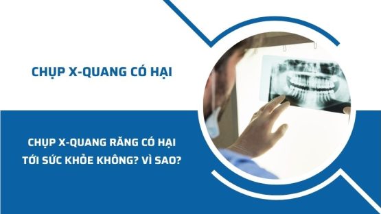 Chụp X-quang răng có hại gì tới sức khỏe hay không? Vì sao?